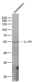 IL-1R1 Rabbit Polyclonal Antib