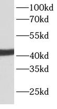 ACTA2 Antibody抗体,orb624472,bio