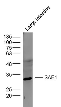 SAE1 Rabbit Polyclonal Antibod