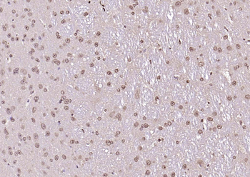 LSM3 Rabbit Polyclonal Antibod