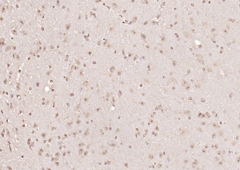 PPM1D Rabbit Polyclonal Antibo
