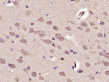 Phospho-c-ABL (Tyr115) Rabbit 