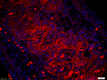 Amphiregulin Rabbit Polyclonal