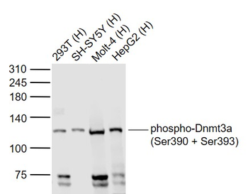 Phospho-Dnmt3a (Ser390 + Ser39
