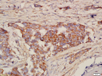 NALP12 Rabbit Polyclonal Antib