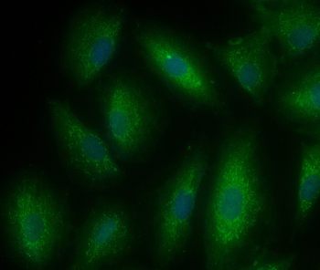 Ferritin Heavy Chain/FTH1 Rabb