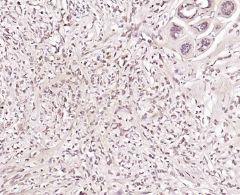 STAT4 Rabbit Polyclonal Antibo