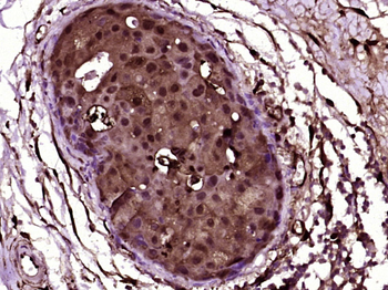 Galectin 3 Mouse Monoclonal An