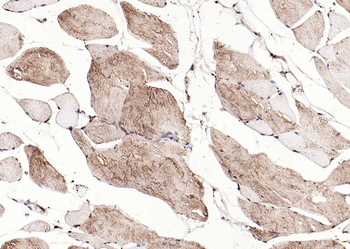 Calreticulin Mouse Monoclonal