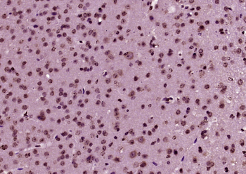 C-fos Rabbit Polyclonal Antibo