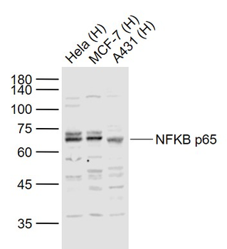 NFKB p65 Rabbit Polyclonal Ant