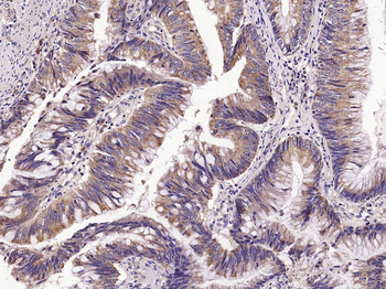 Phospho-IKK beta (S474) Rabbit