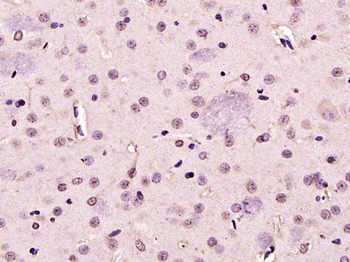 PARK7/DJ1 Rabbit Polyclonal An