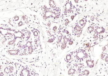 Phospho-BRCA1 (Ser1189) Rabbit