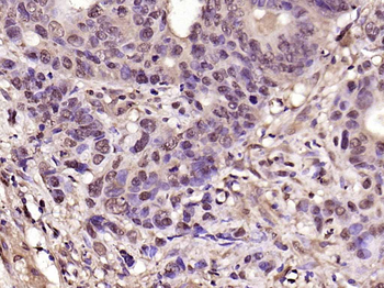 CDK6 Rabbit Polyclonal Antibod