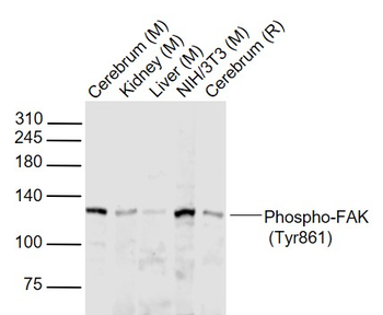 Phospho-FAK (Tyr861) Rabbit Po