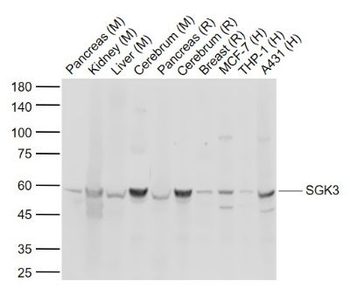 SGK3 Rabbit Polyclonal Antibod