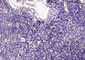 CCR7 Rabbit Polyclonal Antibod