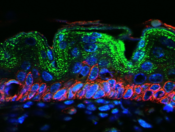 CCL11 Rabbit Polyclonal Antibo
