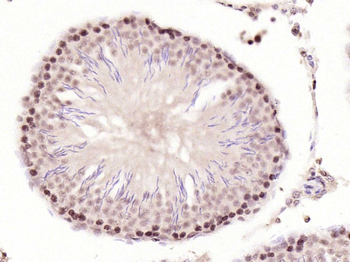 Phospho-CDKN1A/p21 (Thr57) Rab