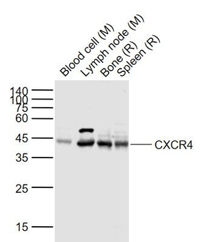 CXCR4 Rabbit Polyclonal Antibo