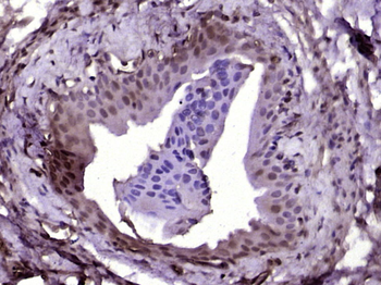 A Raf Rabbit Polyclonal Antibo