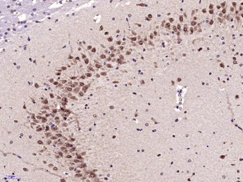 Phospho-RPS6KB1 (Ser417) Rabbi