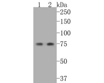 Cytokeratin 1 Recombinant Rabb