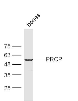PRCP Rabbit Polyclonal Antibod