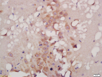 ATG9B Rabbit Polyclonal Antibo