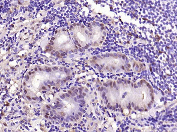 Galectin 3 Mouse Monoclonal An