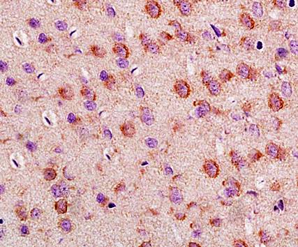 LLGL1 Rabbit Polyclonal Antibo