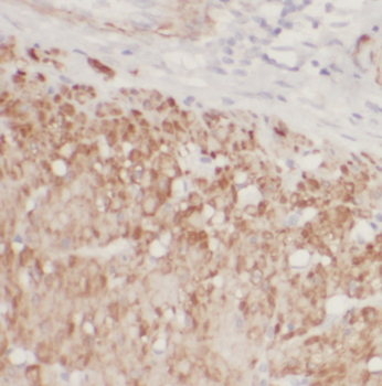 DDX21 Antibody抗体，orb626311，bio