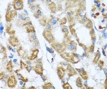 ANTXR2 Antibody抗体,orb624747,bi