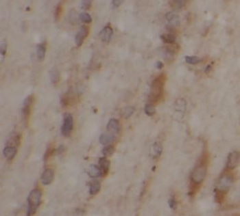 ALDH1A1 Antibody抗体,orb624615,b