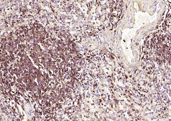 CD45 Mouse Monoclonal Antibody