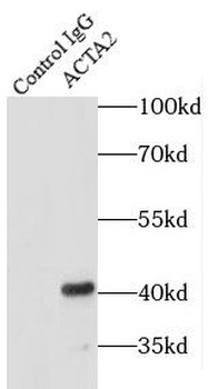 ACTA2 Antibody抗体,orb624472,bio