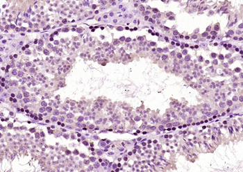 NR2C2 Rabbit Polyclonal Antibo