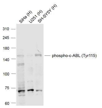 Phospho-c-ABL (Tyr115) Rabbit 