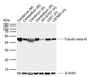 Tubulin beta-III Recombinant R