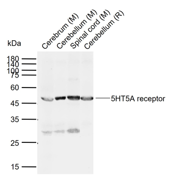 5HT5A receptor Rabbit Polyclon