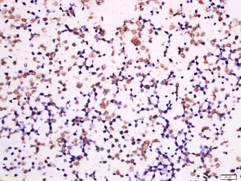 Phospho-P53 (Ser392) Rabbit Po