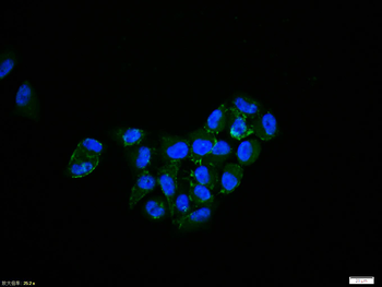 Phospho-EGFR (Tyr1110) Rabbit 