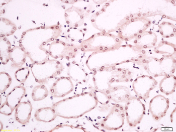 Phospho-P53 (Ser392) Rabbit Po