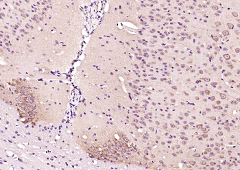 Factor B Rabbit Polyclonal Ant