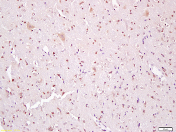 Phospho-beta catenin (Tyr142)