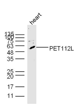 PET112L Rabbit Polyclonal Anti