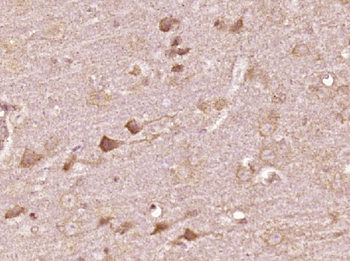 VAT1L Rabbit Polyclonal Antibo