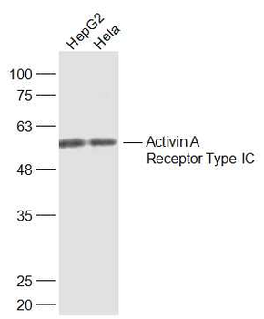 Activin A Receptor Type IC Rab