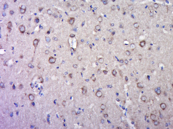 GLUR2 Rabbit Polyclonal Antibo